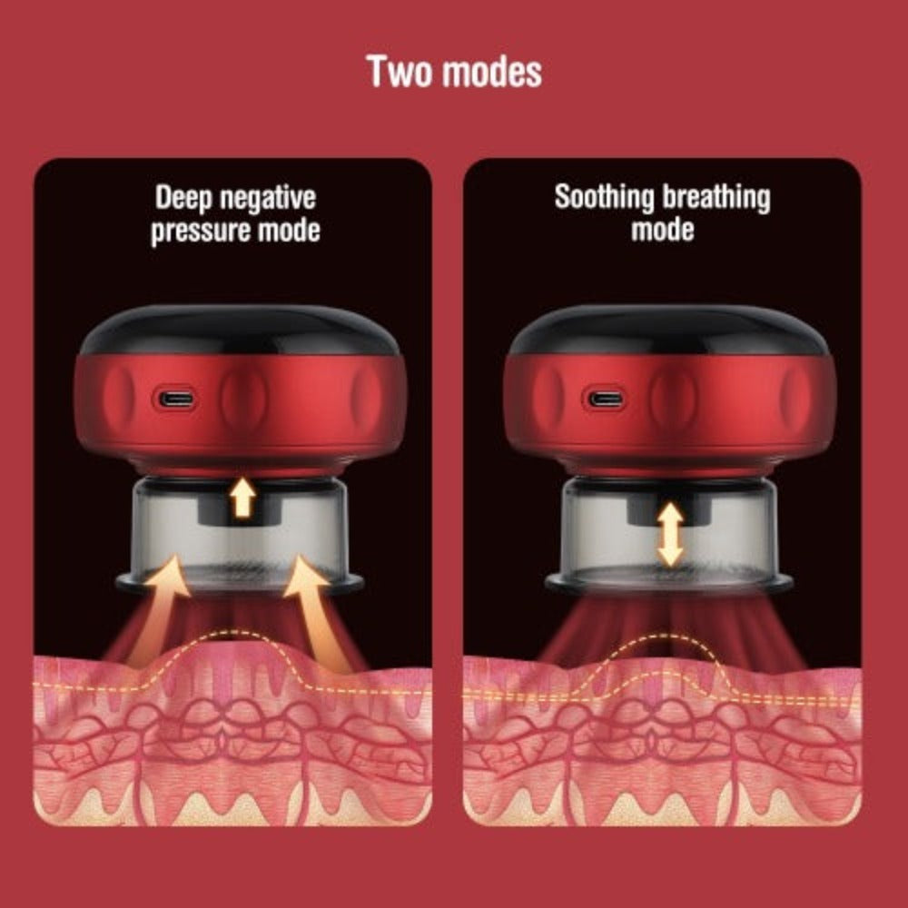 Electric Cupping Method